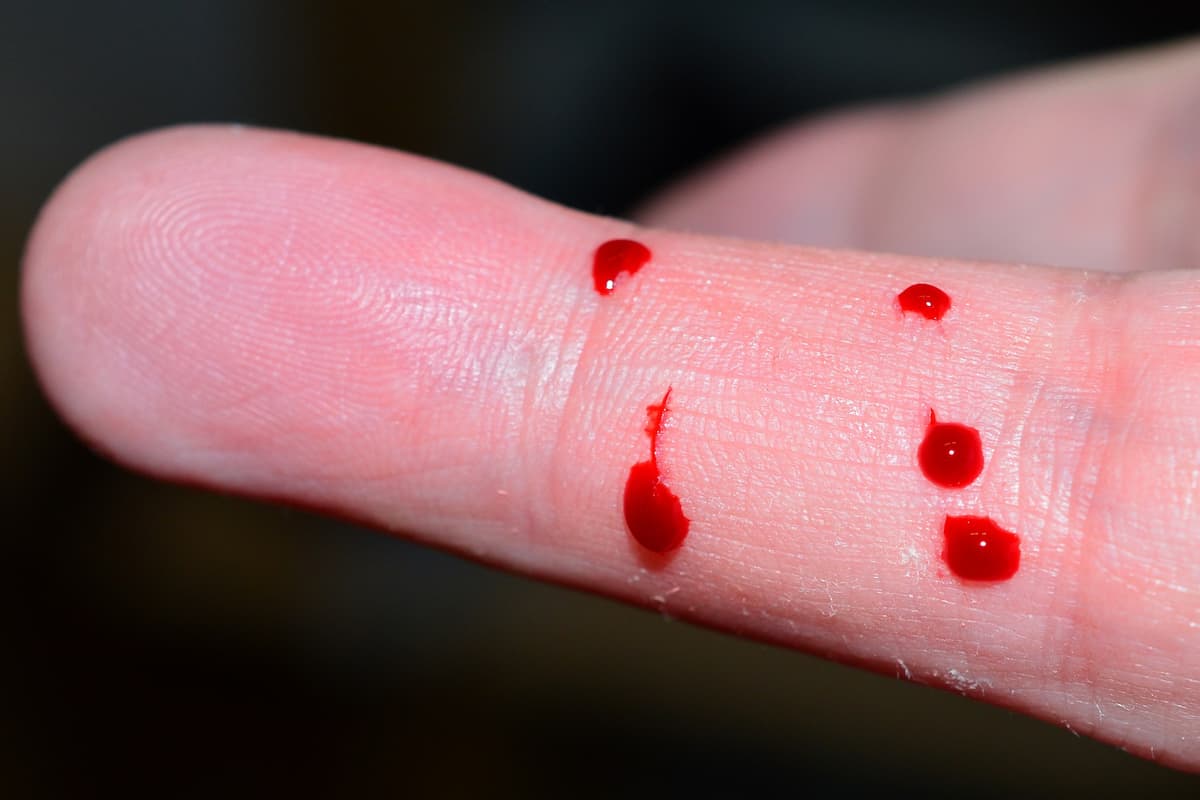 Close-up photo of blood drops on a person's finger. 